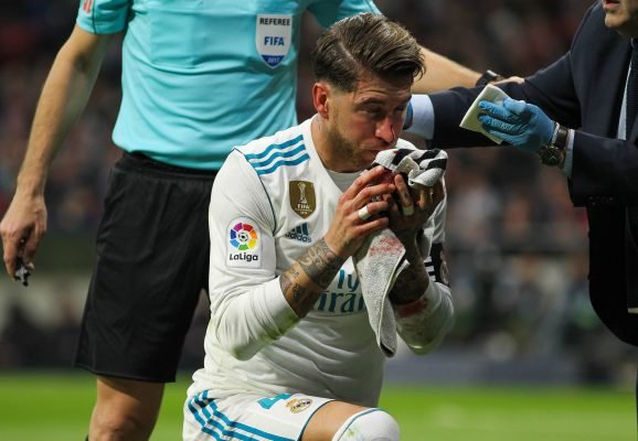 Sergio Ramos posts gruesome image after breaking nose in Madrid derby
